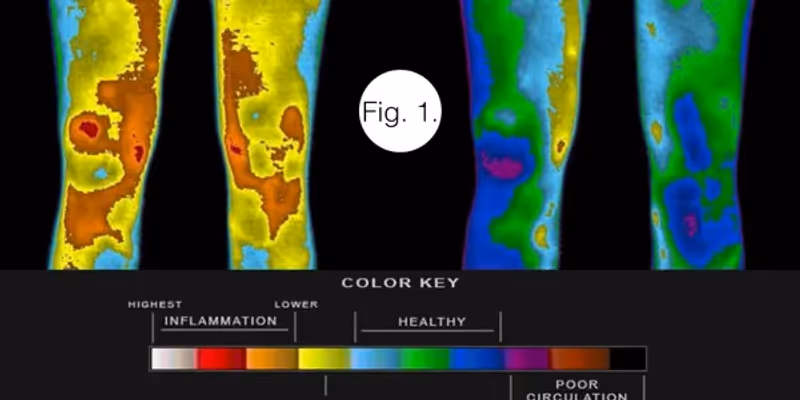Thermal imaging of knee pain before and after grounding