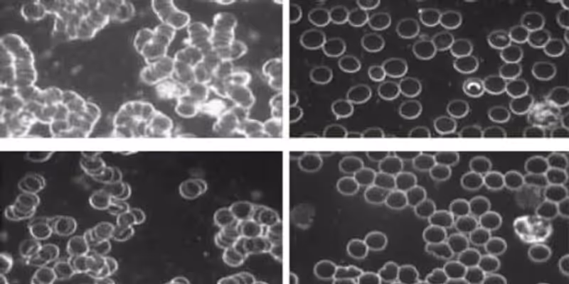 Blood viscosity comparison before and after grounding